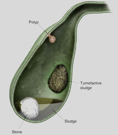 Gall bladder 